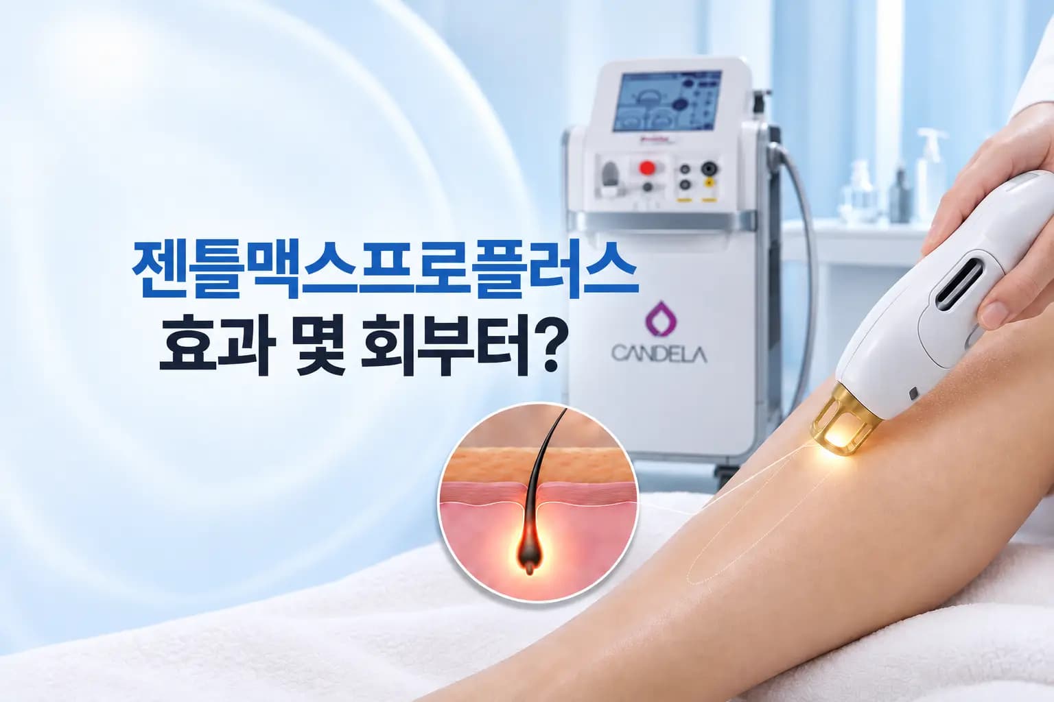 젠틀맥스프로플러스 핸드피스가 다리 피부에 레이저를 조사하고 모낭 확대 컷을 더한 효과 썸네일