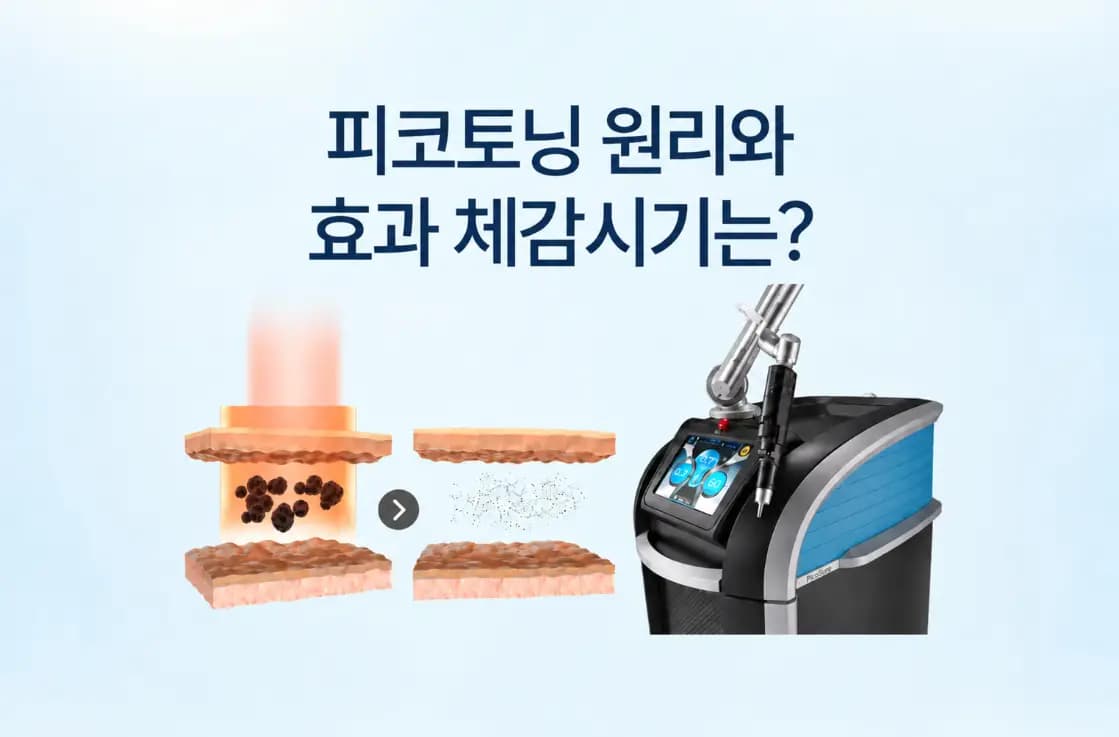 피코슈어 장비와 멜라닌 색소가 작은 입자로 분해되는 과정을 조합한 피코토닝 효과 썸네일