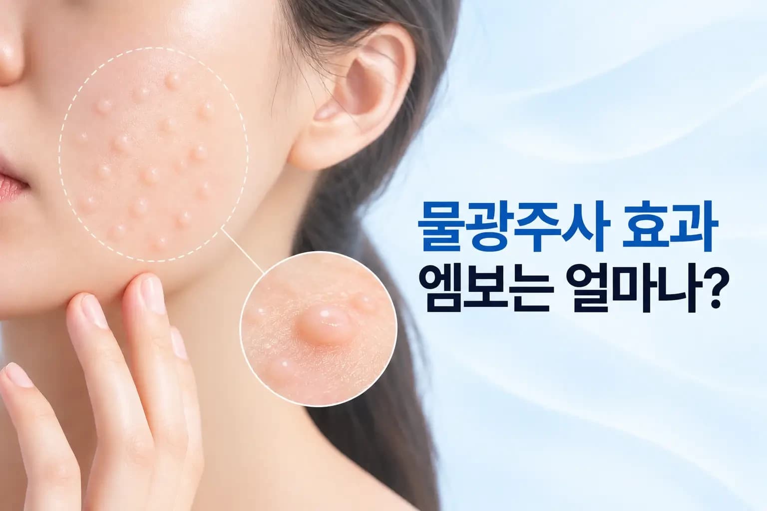 볼 피부에 남은 작은 엠보와 히알루론산 주입 단면 확대 컷을 조합한 물광주사 부작용 썸네일