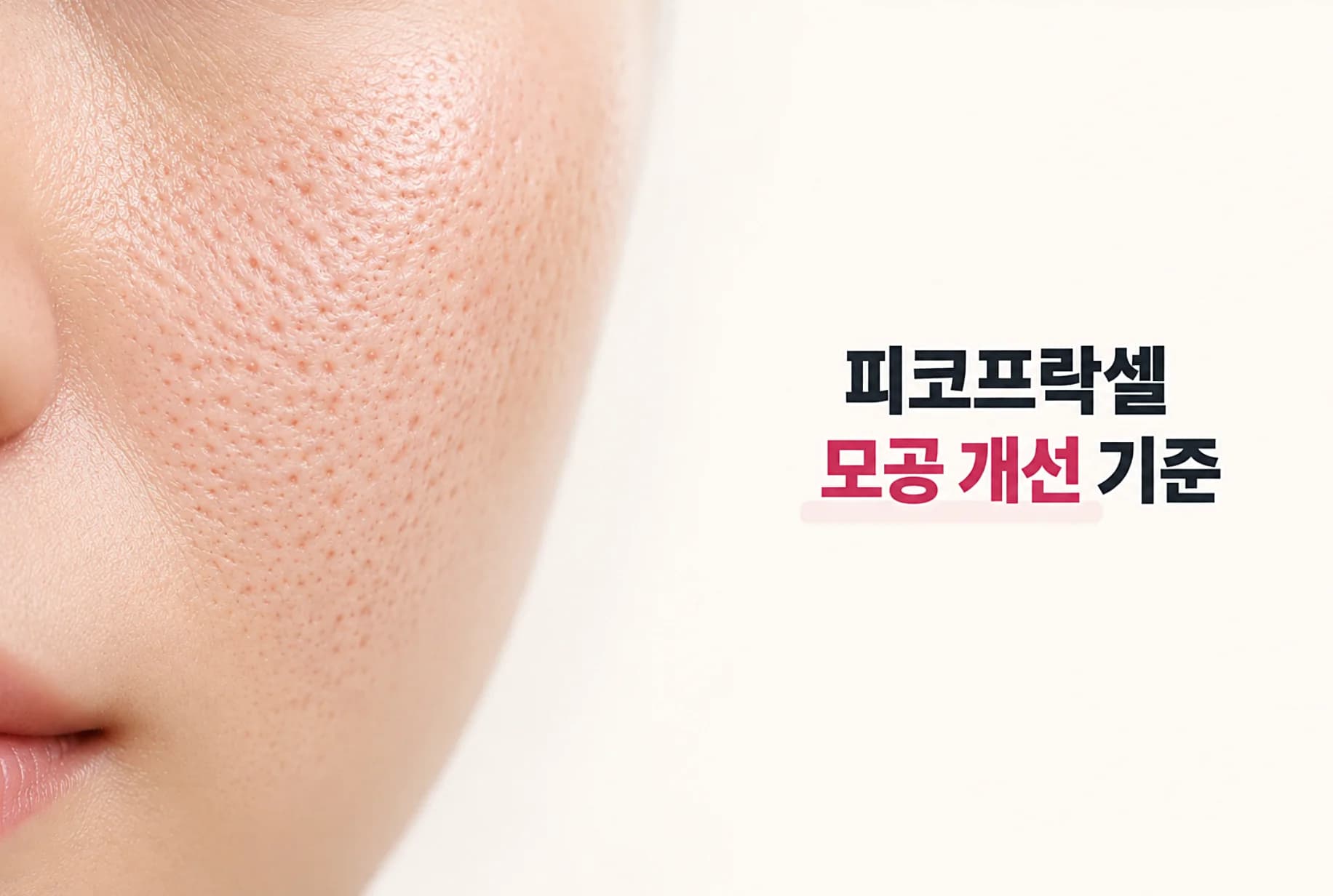 늘어난 모공과 피부 결 개선을 위한 피코프락셀 시술 원리와 회복 과정을 안내하는 대표 이미지